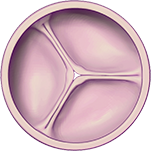 Graphic of a normal heart valve